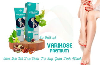 Sự thật về Varikose Premium - Kem Bôi Hỗ Trợ Điều Trị Suy Giãn Tĩnh Mạch