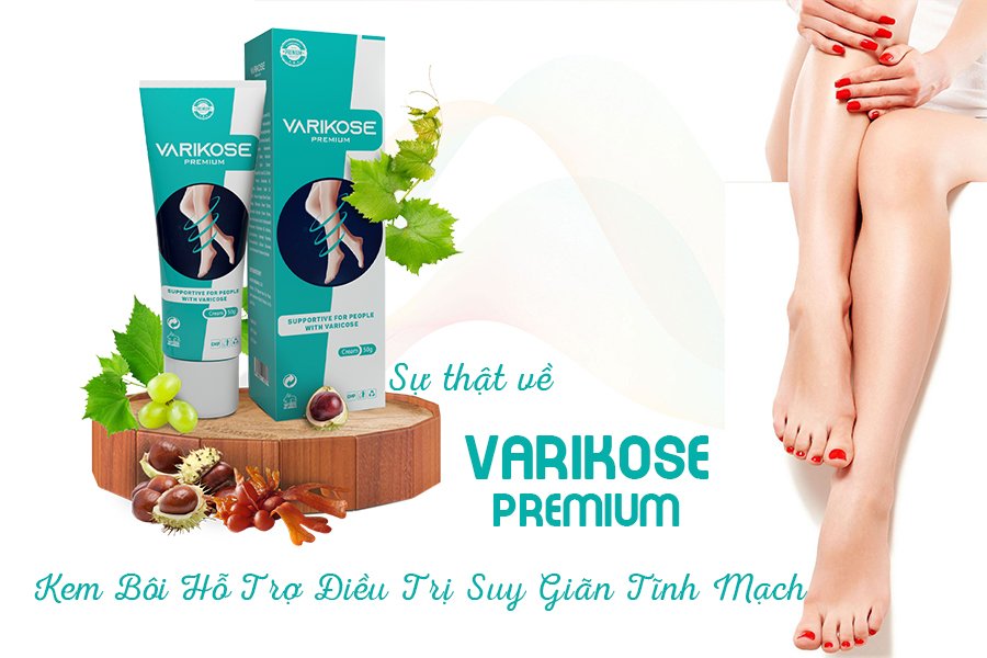 Sự thật về Varikose Premium - Kem Bôi Hỗ Trợ Điều Trị Suy Giãn Tĩnh Mạch